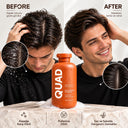 QUAD Anti-Dandruff Shampoo – Kepek Karşıtı Dengeleyici Şampuan