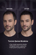 QUAD UNISEX Siyah Saç & Sakal Kapatıcı Dolgunlaştırıcı Pudra – Doğal Topik Etki 10gr